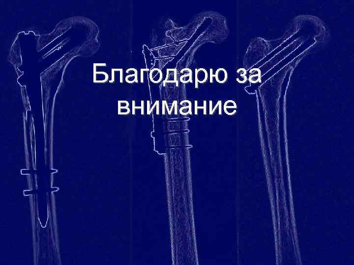 Благодарю за внимание 