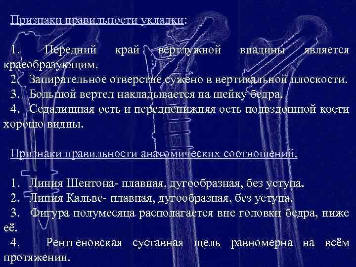 Признаки правильности укладки: 1. Передний край вертлужной впадины является краеобразующим. 2. Запирательное отверстие сужено