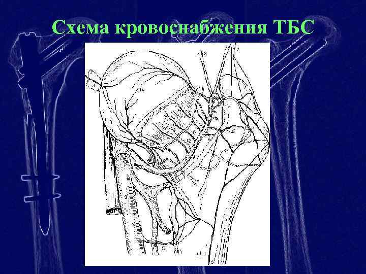 Кровоснабжение тазобедренного сустава схема