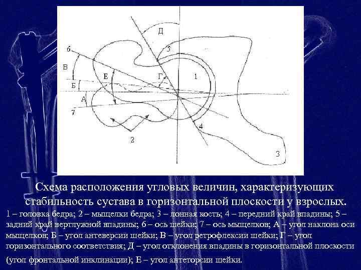 Схема расположения угловых величин, характеризующих стабильность сустава в горизонтальной плоскости у взрослых. 1 –