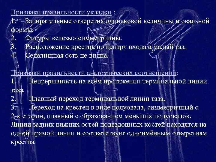 Признаки правильности укладки : 1. Запирательные отверстия одинаковой величины и овальной формы. 2. Фигуры