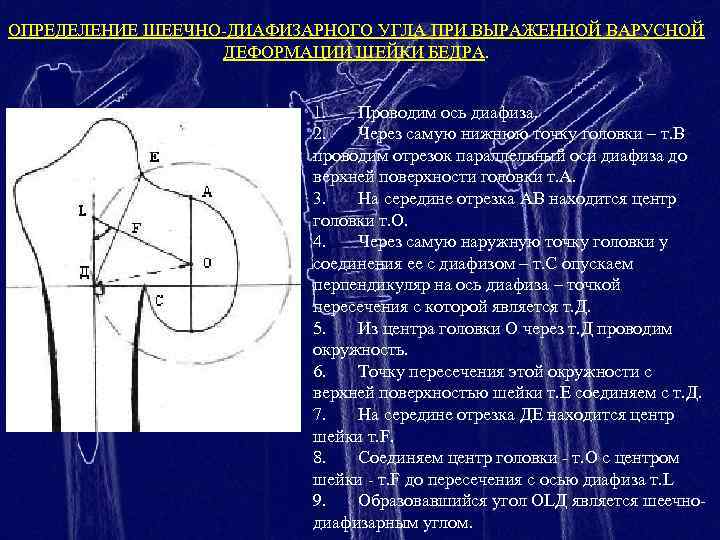 Переломы проксимального отдела бедренной кости тесты нмо