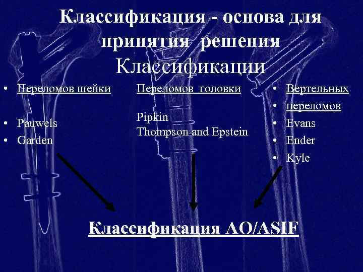 Классификация - основа для принятия решения Классификации • Переломов шейки Переломов головки • Pauwels