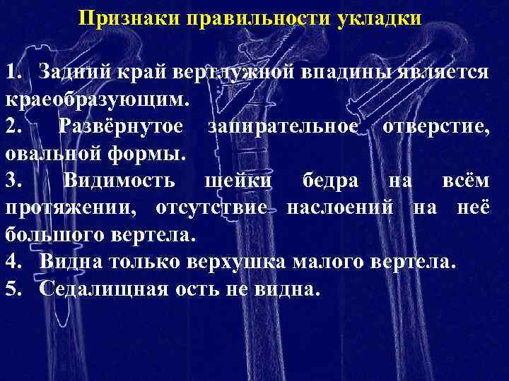 Признаки правильности укладки 1. Задний край вертлужной впадины является краеобразующим. 2. Развёрнутое запирательное отверстие,