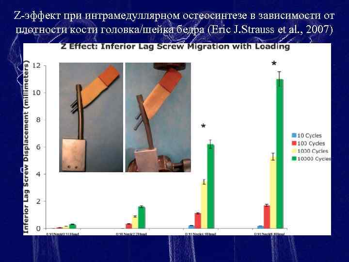 Z-эффект при интрамедуллярном остеосинтезе в зависимости от плотности кости головка/шейка бедра (Eric J. Strauss