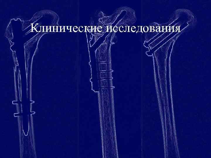 Клинические исследования 