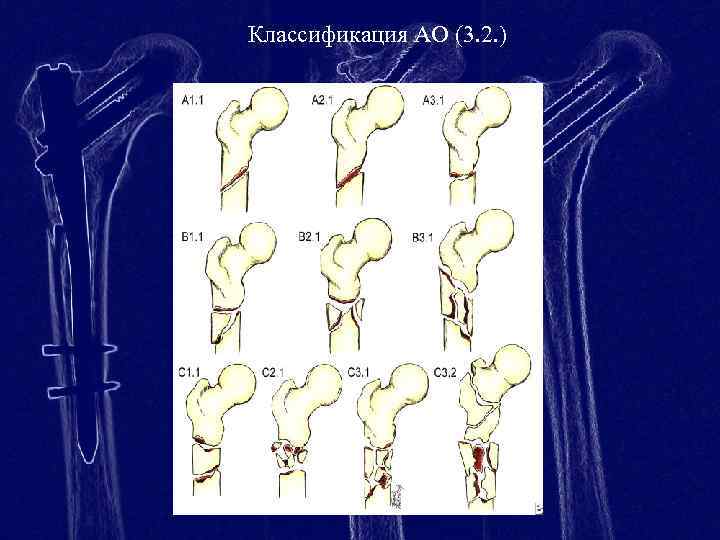 Классификация АО (3. 2. ) 