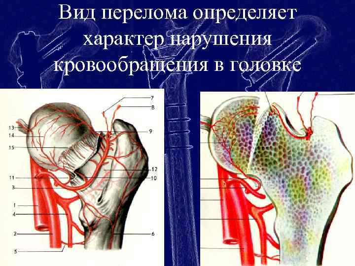 Карте суставов. Кровоснабжение проксимального отдела бедра. Кровоснабжение головки бедренной кости. Кровоснабжение проксимального отдела бедренной кости. Проксимальный сустав.