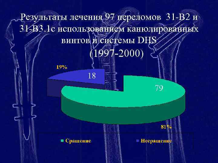 Результаты лечения 97 переломов 31 -В 2 и 31 -В 3. 1 с использованием