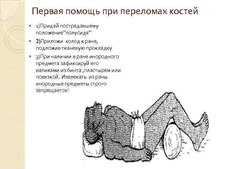 Первая помощь при переломах костей 1)Придай пострадавшему положение”полусидя” 2)Приложи холод к ране, подложив тканевую