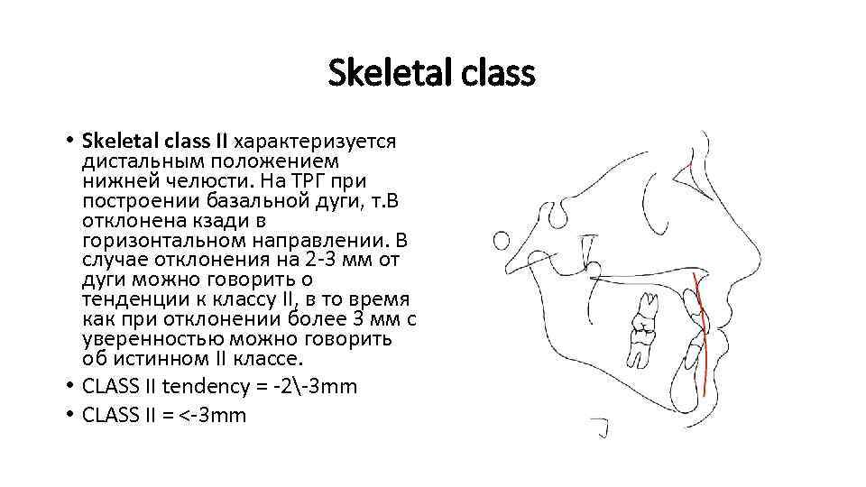 Skeletal class • Skeletal class II характеризуется дистальным положением нижней челюсти. На ТРГ при