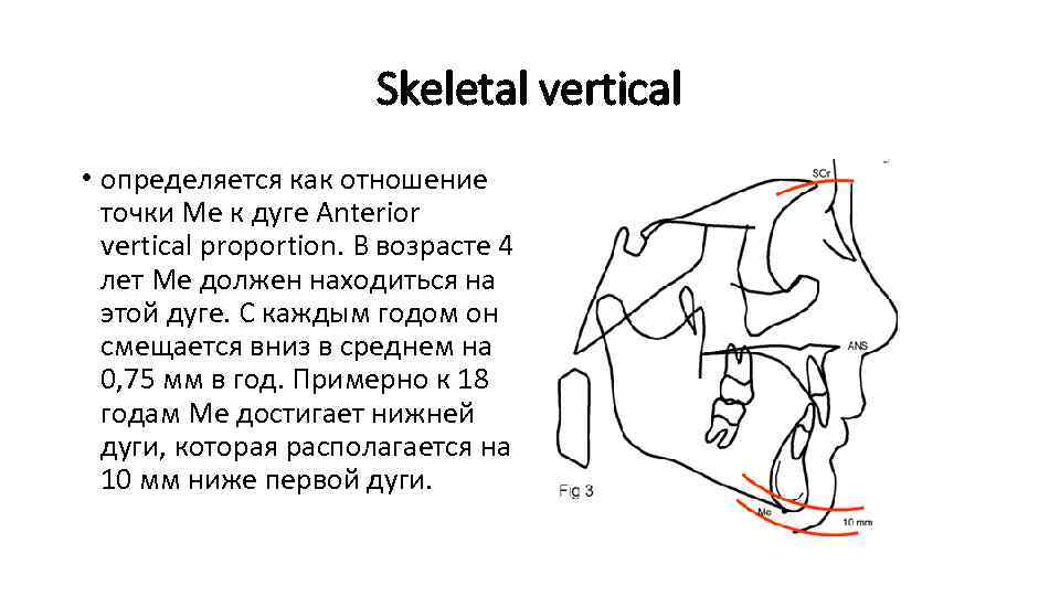 Skeletal vertical • определяется как отношение точки Ме к дуге Anterior vertical proportion. В