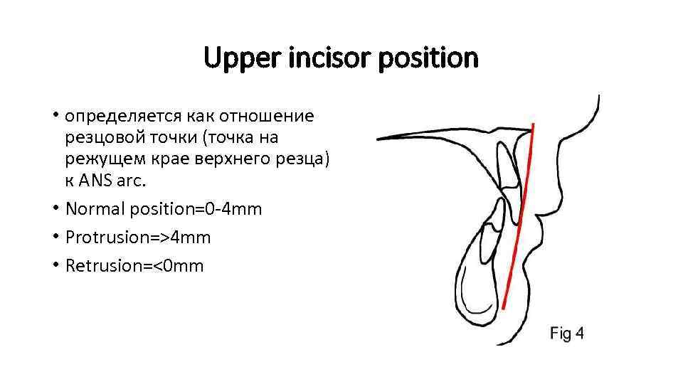 Upper incisor position • определяется как отношение резцовой точки (точка на режущем крае верхнего