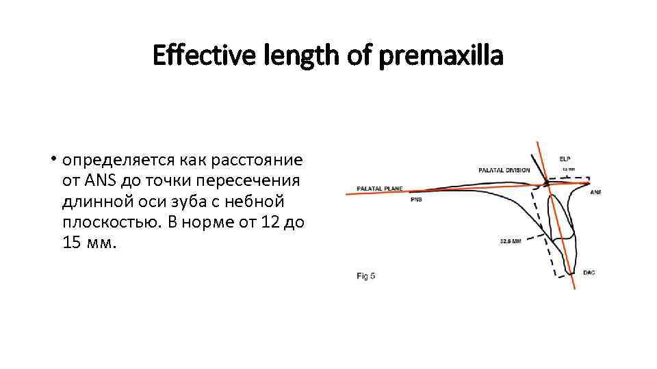 Effective length of premaxilla • определяется как расстояние от ANS до точки пересечения длинной