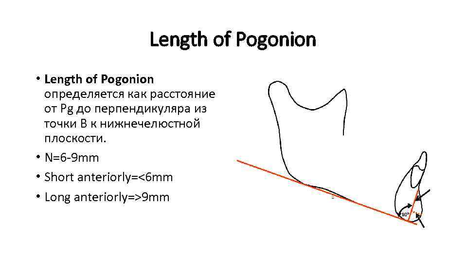 Length of Pogonion • Length of Pogonion определяется как расстояние от Pg до перпендикуляра