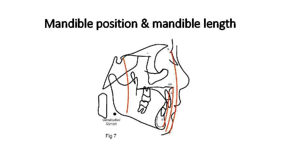 Mandible position & mandible length 