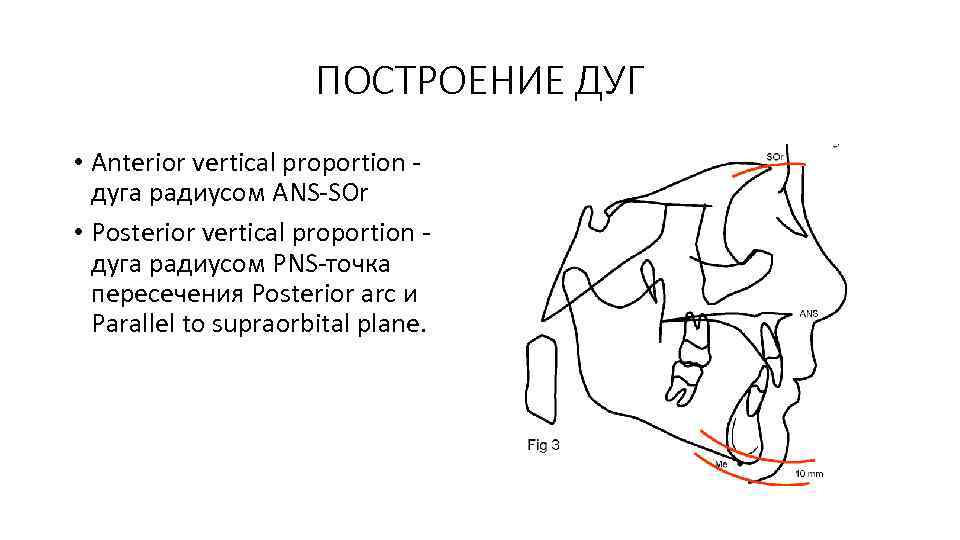 ПОСТРОЕНИЕ ДУГ • Anterior vertical proportion дуга радиусом ANS-SOr • Posterior vertical proportion дуга