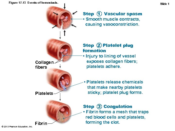 Figure 17. 13 Events of hemostasis. Slide 1 Step 1 Vascular spasm • Smooth