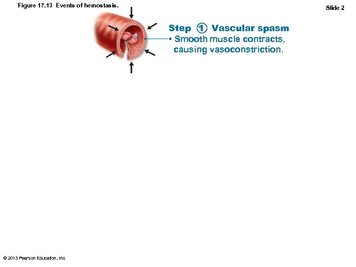 Figure 17. 13 Events of hemostasis. Slide 2 Step 1 Vascular spasm • Smooth