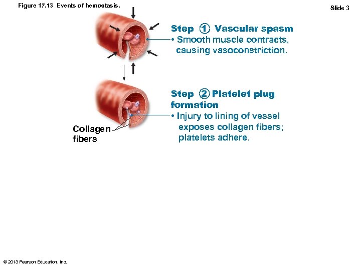 Figure 17. 13 Events of hemostasis. Slide 3 Step 1 Vascular spasm • Smooth