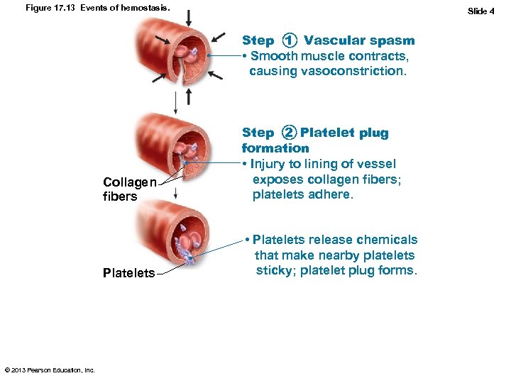 Figure 17. 13 Events of hemostasis. Slide 4 Step 1 Vascular spasm • Smooth