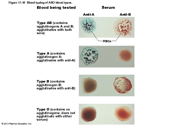 Figure 17. 16 Blood typing of ABO blood types. Serum Blood being tested Anti-B