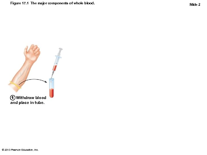 Figure 17. 1 The major components of whole blood. 1 Withdraw blood and place