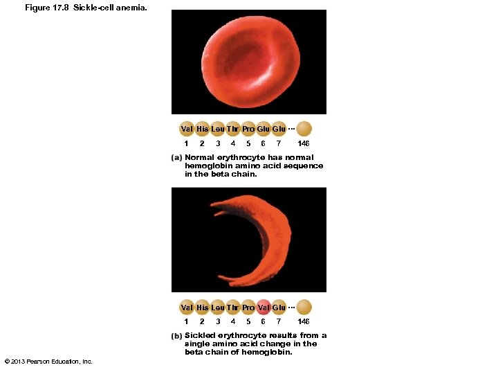 Figure 17. 8 Sickle-cell anemia. Val His Leu Thr Pro Glu … 1 2