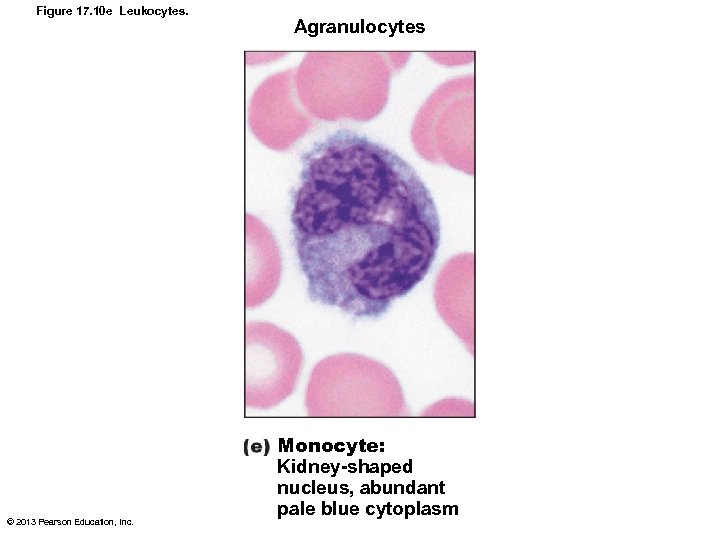 Figure 17. 10 e Leukocytes. © 2013 Pearson Education, Inc. Agranulocytes Monocyte: Kidney-shaped nucleus,