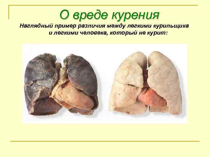 О вреде курения Наглядный пример различия между легкими курильщика и легкими человека, который не
