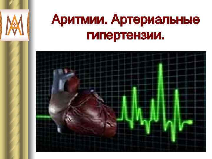 Аритмии. Артериальные гипертензии. 