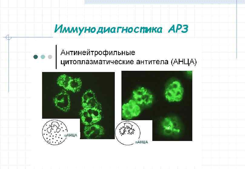 Иммунодиагностика АРЗ 