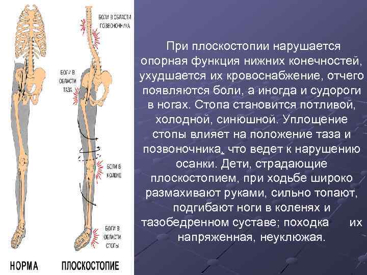  При плоскостопии нарушается опорная функция нижних конечностей, ухудшается их кровоснабжение, отчего появляются боли,