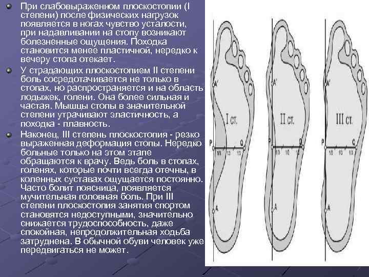 При слабовыраженном плоскостопии (I степени) после физических нагрузок появляется в ногах чувство усталости, при