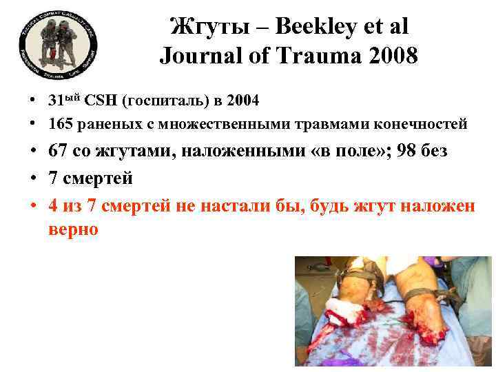 Жгуты – Beekley et al Journal of Trauma 2008 • 31 ый CSH (госпиталь)