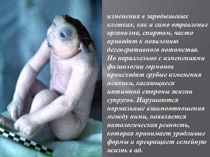 изменения в зародышевых клетках, как и само отравление организма, спиртом, часто приводят к появлению