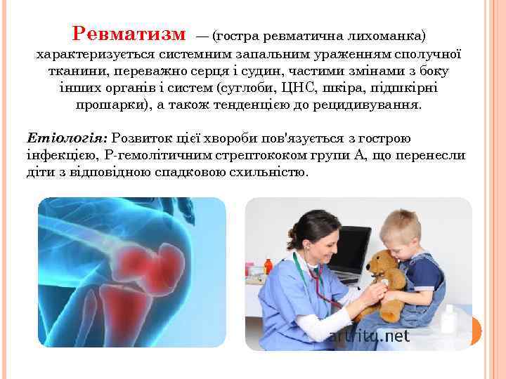 Ревматизм — (гостра ревматична лихоманка) характеризується системним запальним ураженням сполучної тканини, переважно серця і