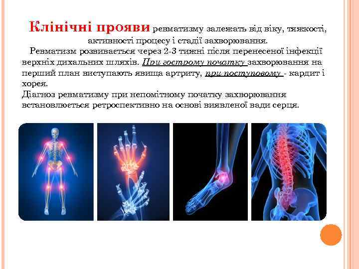 Клінічні прояви ревматизму залежать від віку, тяжкості, активності процесу і стадії захворювання. Ревматизм розвивається