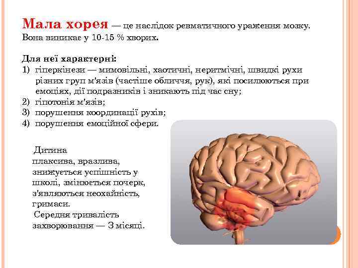 Мала хорея — це наслідок ревматичного ураження мозку. Вона виникає у 10 15 %