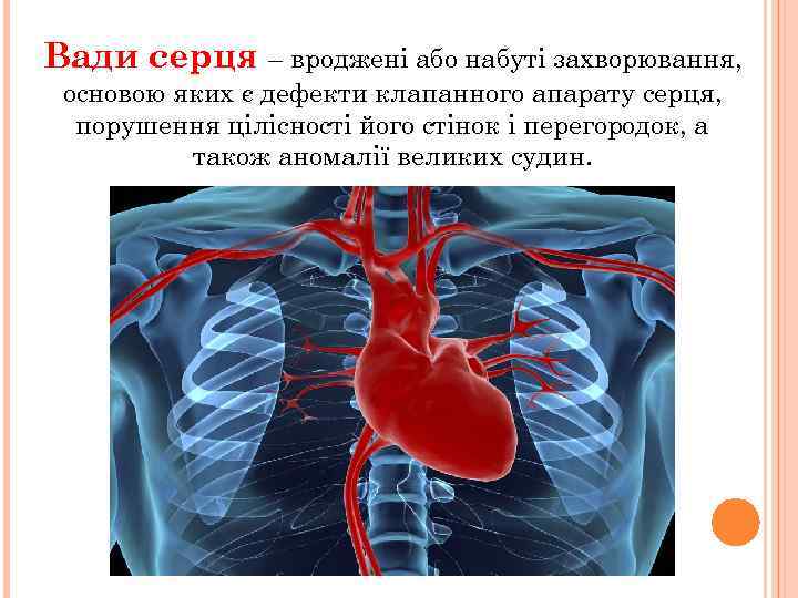 Вади серця – вроджені або набуті захворювання, основою яких є дефекти клапанного апарату серця,