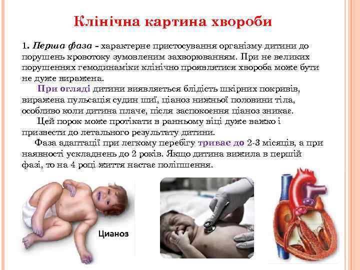 Клінічна картина хвороби 1. Перша фаза - характерне пристосування організму дитини до порушень кровотоку