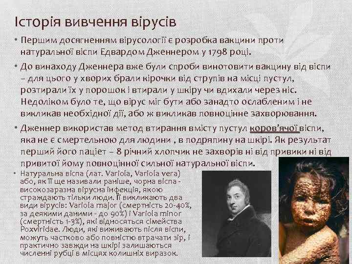 Історія вивчення вірусів • Першим досягненням вірусології є розробка вакцини проти натуральної віспи Едвардом
