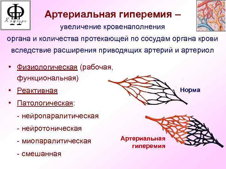 Признаки венозной гиперемии рисунок