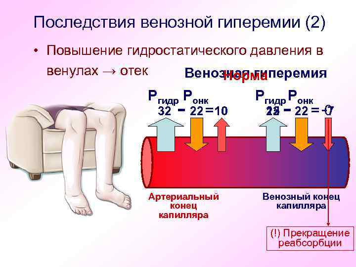 Последствия венозной гиперемии (2) • Повышение гидростатического давления в венулах → отек Венозная гиперемия