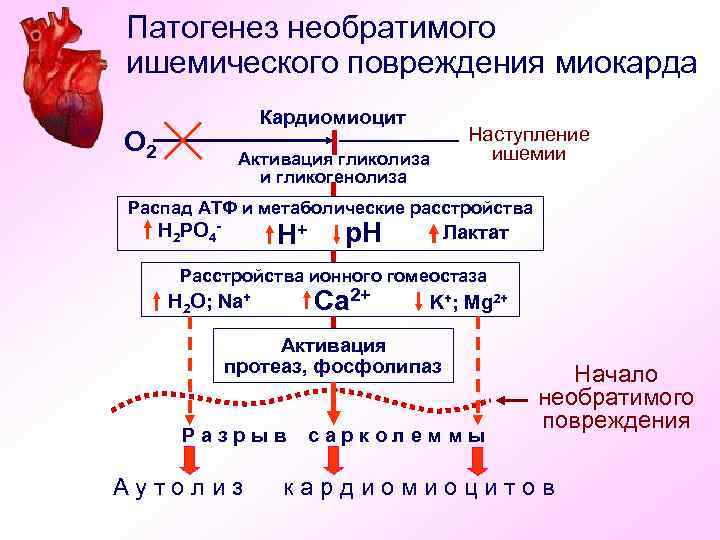 Патогенез необратимого ишемического повреждения миокарда Кардиомиоцит О 2 Активация гликолиза и гликогенолиза Наступление ишемии