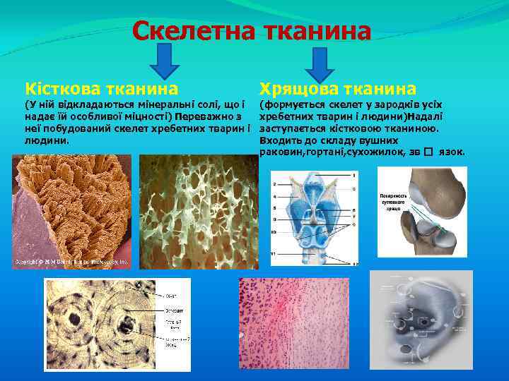 Скелетна тканина Кісткова тканина (У ній відкладаються мінеральні солі, що і надає їй особливої