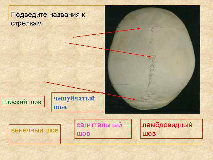 Подведите названия к стрелкам плоский шов чешуйчатый шов венечный шов сагиттальный шов ламбдовидный шов