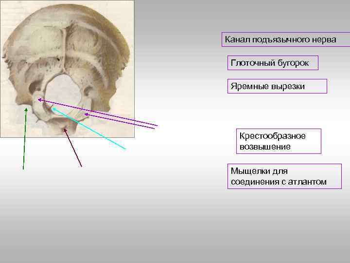 Глоточный бугорок