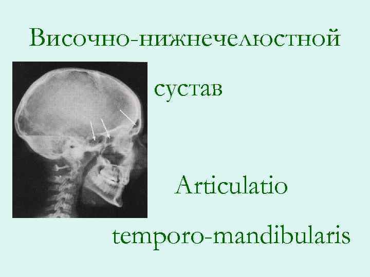 Височно-нижнечелюстной сустав Articulatio temporo-mandibularis 