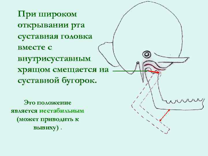 При широком открывании рта суставная головка вместе с внутрисуставным хрящом смещается на суставной бугорок.